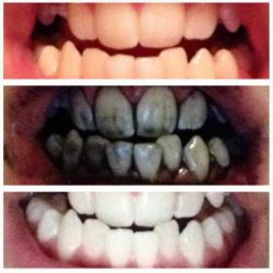NATURAL BAMBOO CHARCOAL TEETH WHITENER TOOTHPASTE