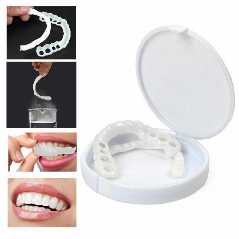 SNAP ON DENTAL VENEERS - RunSpree.com